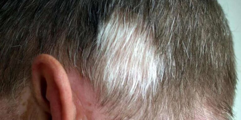 wellhealthorganic.com/know-the-causes-of-white-hair-and-easy-ways-to-prevent-it-naturally
